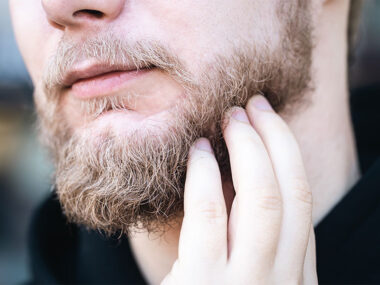 Battling-Beard-Dandruff-Beardruff-Prevention-Recovery-and-Your-Roadmap-to-a-Flake-Free-Beard-Beard-Game-Strong